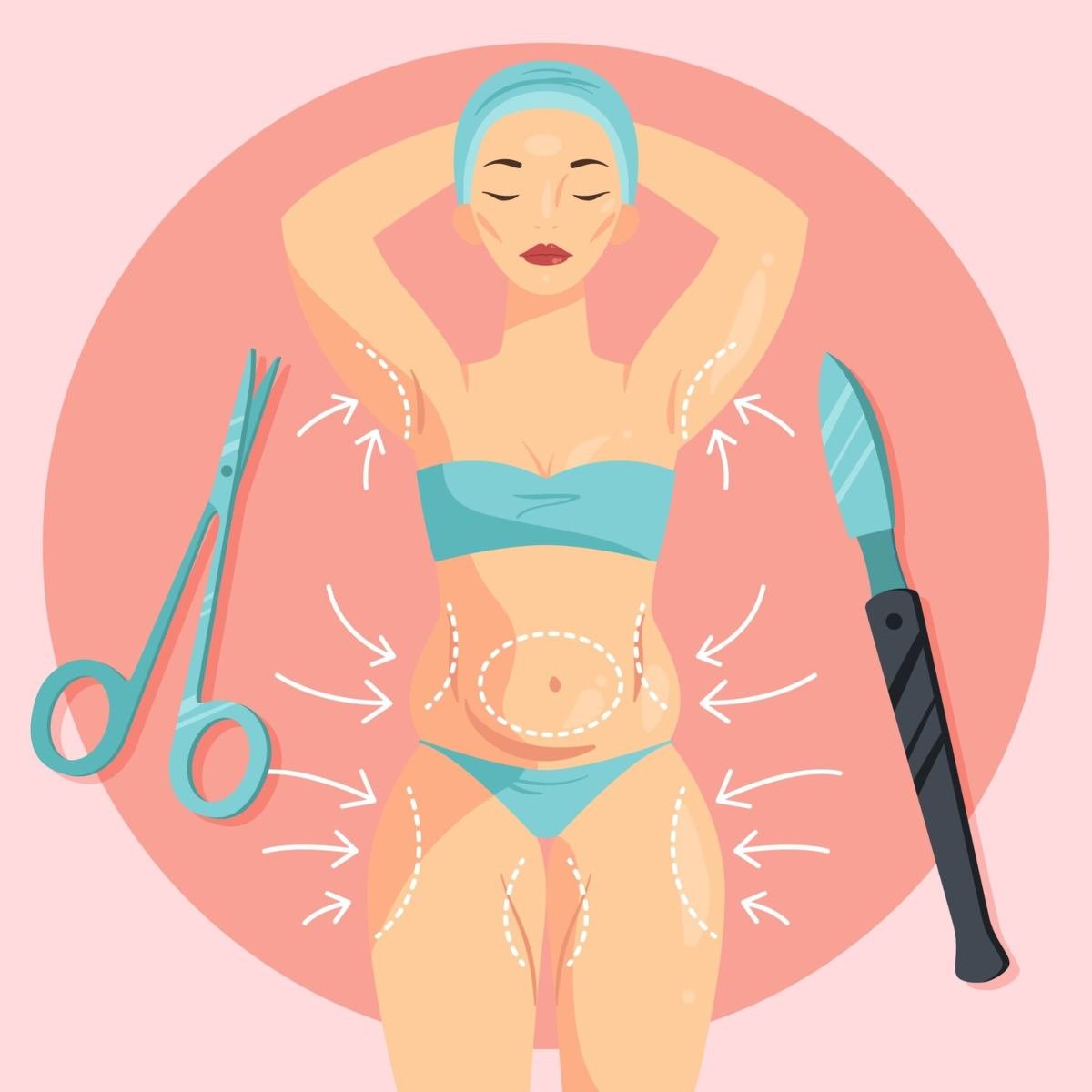 Best Ways to Speed Up Your Recovery After Plastic Surgery