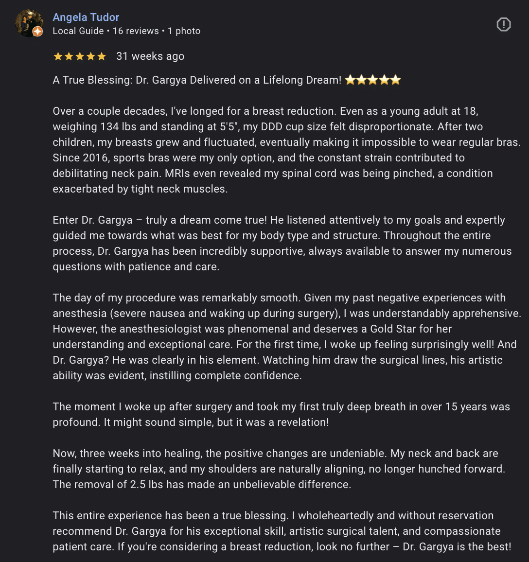 Angela Ballerina Breast