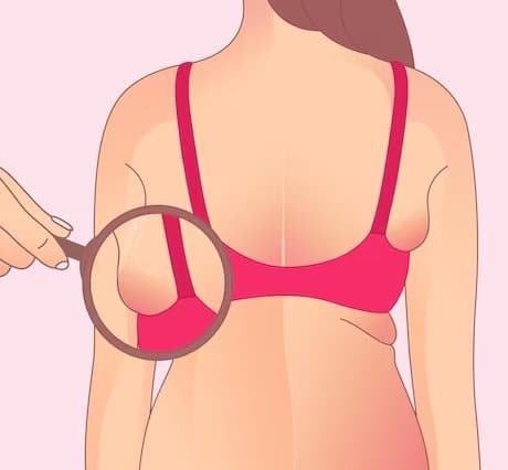 What Is a Tiny Boob Job? The Modern Make-Under Explained