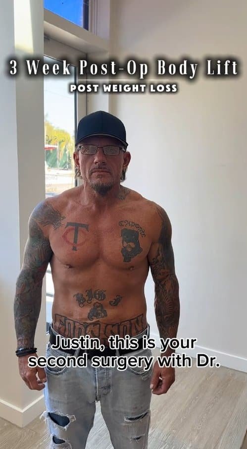 Justin’s Story