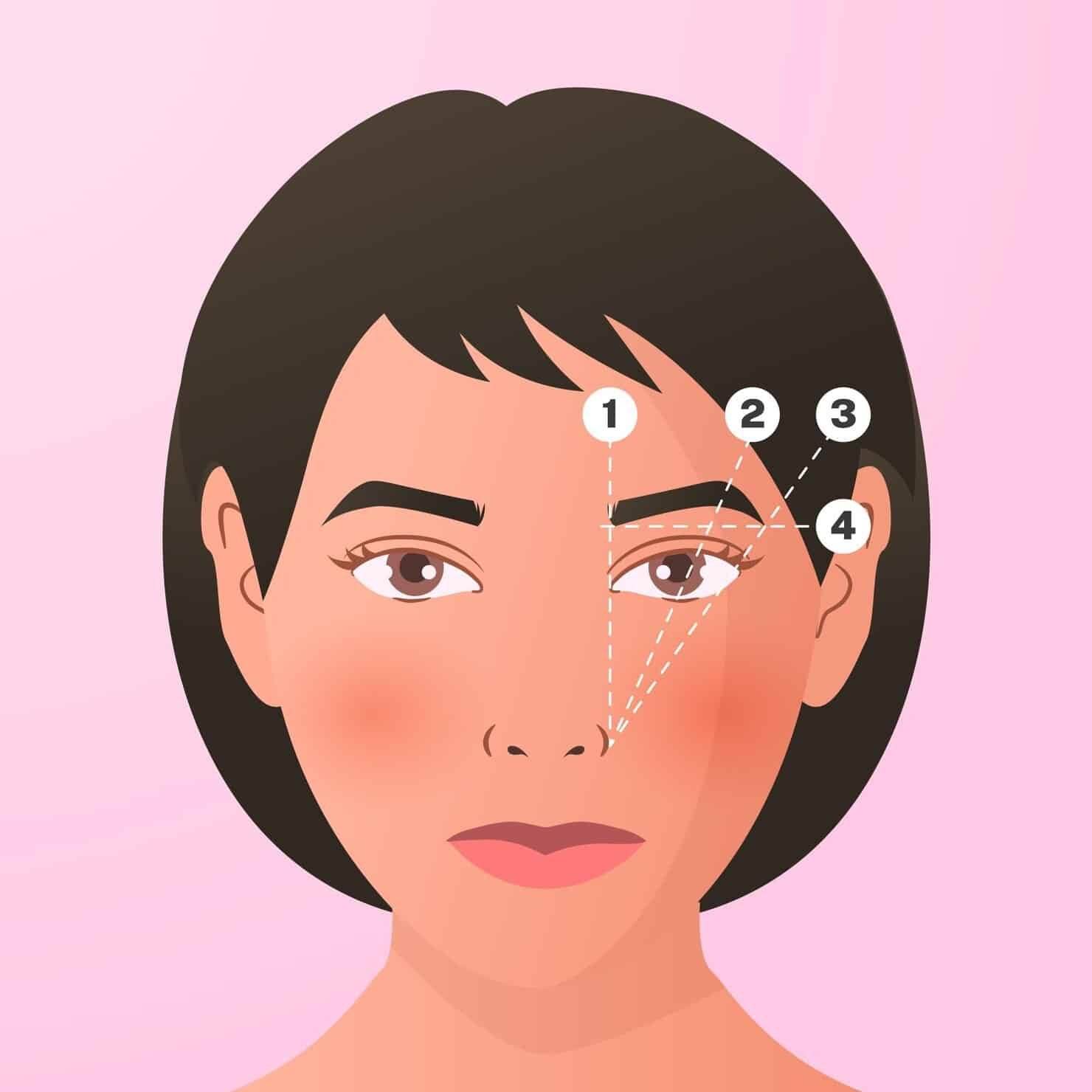 Facelift-Scars-Around-the-Ear